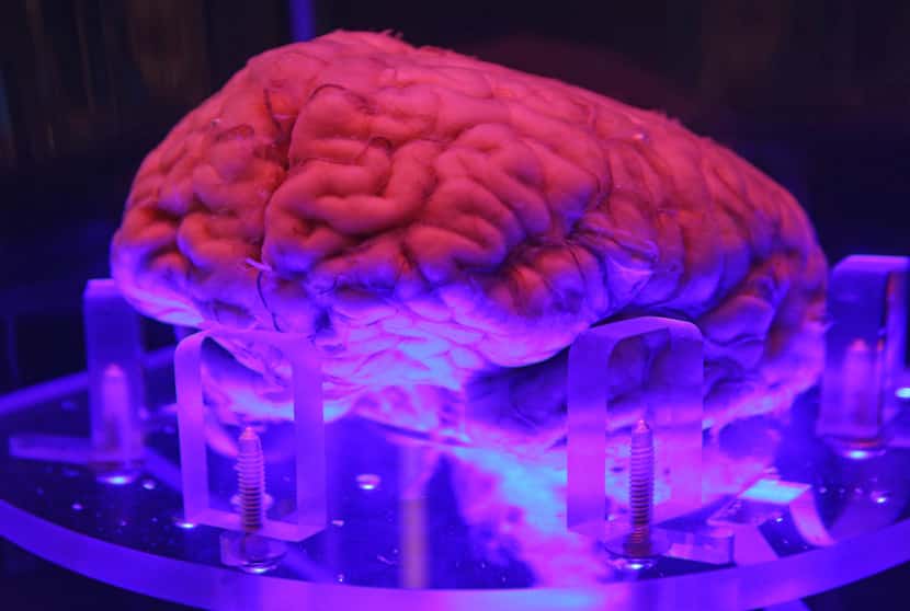 UT Southwestern Medical Center donated a human brain that is on display in a case of diluted...