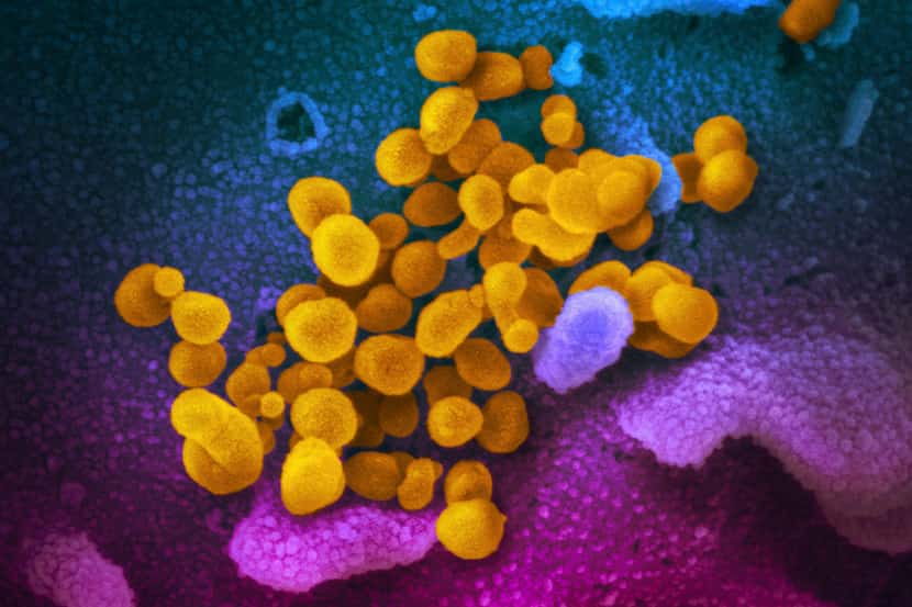 Células de coronavirus, indicadas en amarillo, saliendo de la superficie de células marcadas...