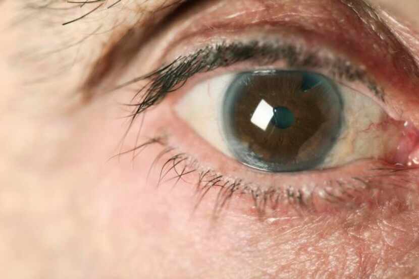 
Statins might raise the odds of developing cataracts by 27 percent, a recent study shows.
