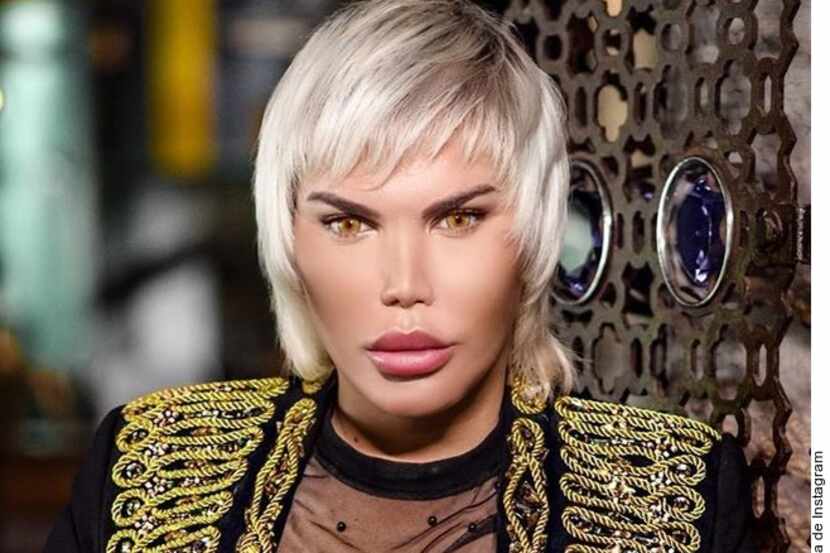 foto de Rodrigo Alves con rasgos de cirugía cosmética.