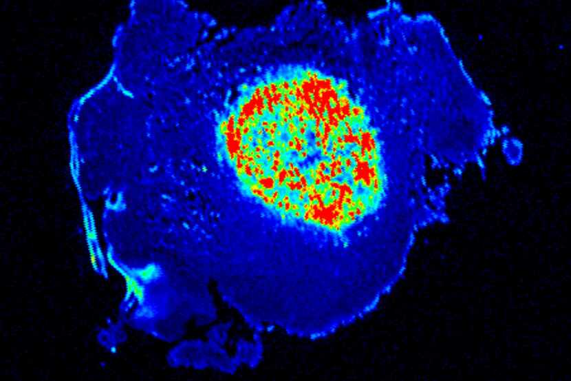 Illuminated cancer cells fron study in mice.