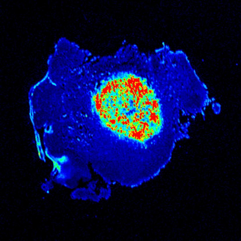 Illuminated cancer cells fron study in mice.