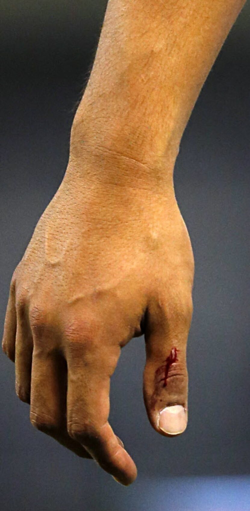 Texas Rangers starting pitcher Yu Darvish's pitching thumb bleeds as he walks to the dugout...