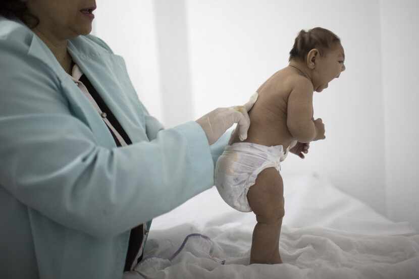  Lara, who is less then 3 months old and was born with microcephaly, is examined by a...