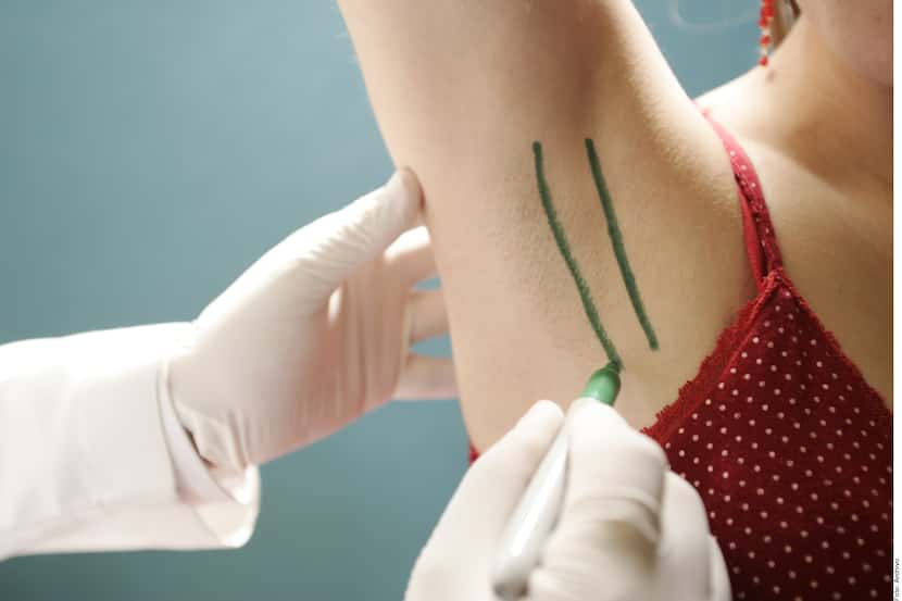 Foto de un doctor haciéndole marcas con un marcador en las xilas de una mujer.