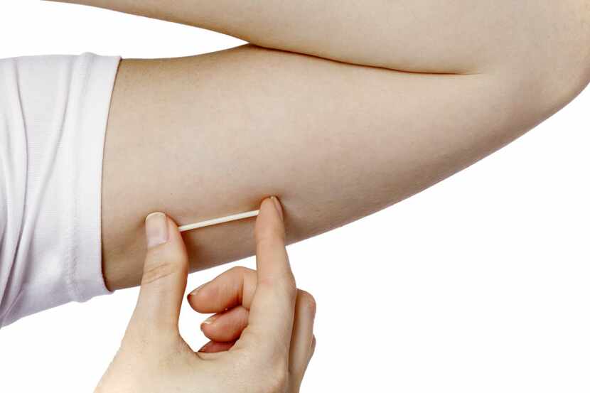  A model holds a hormonal implant for birth control. Better access to newer, more effective...