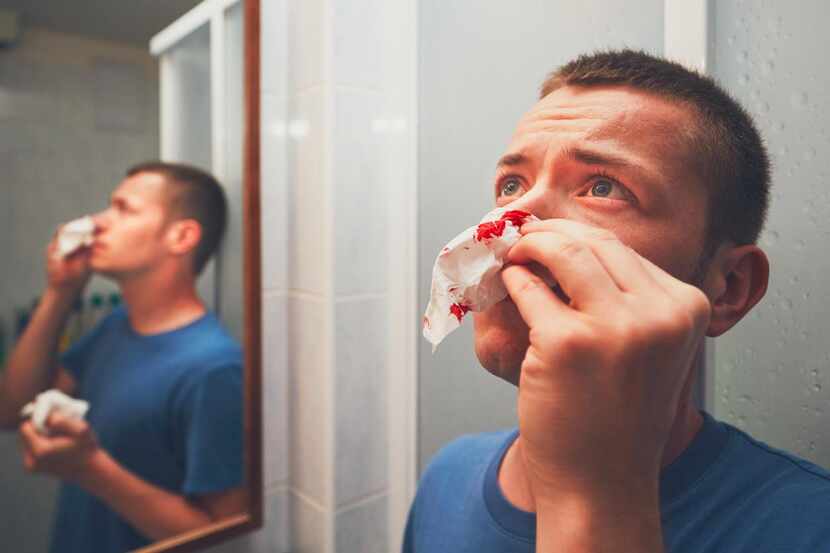 Una persona se toponea una fosa nasal para evirar sangrado por la nariz.(getty images)
