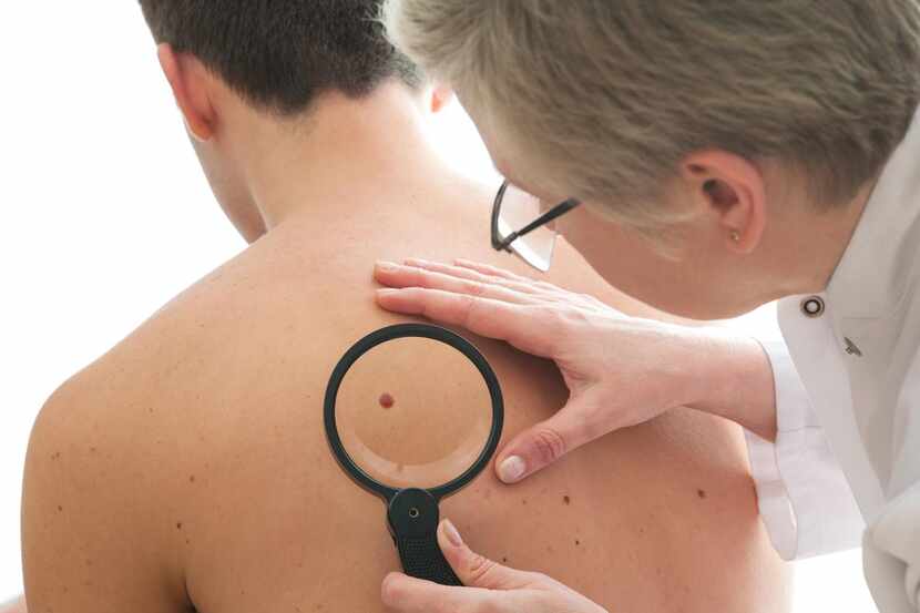 Un dermatólogo examina la piel de un paciente. (Getty Images/iStockphoto/AlexRaths)
