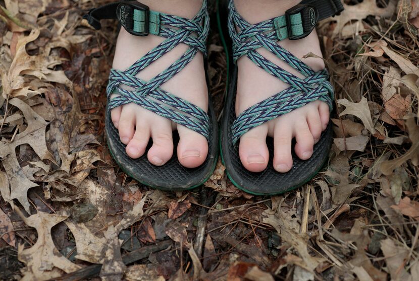 Oakley Yoder shows her now-deformed toe after a snake bit her at an Illinois summer camp in...