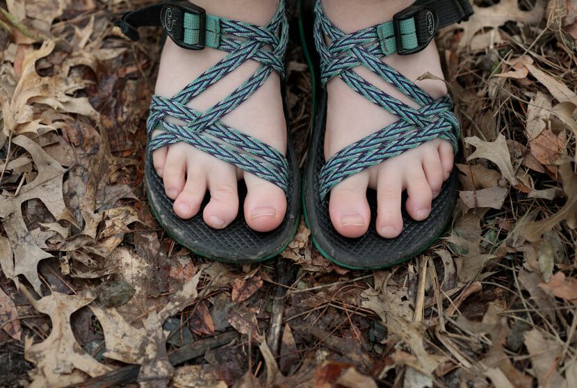 Oakley Yoder shows her now-deformed toe after a snake bit her at an Illinois summer camp in...