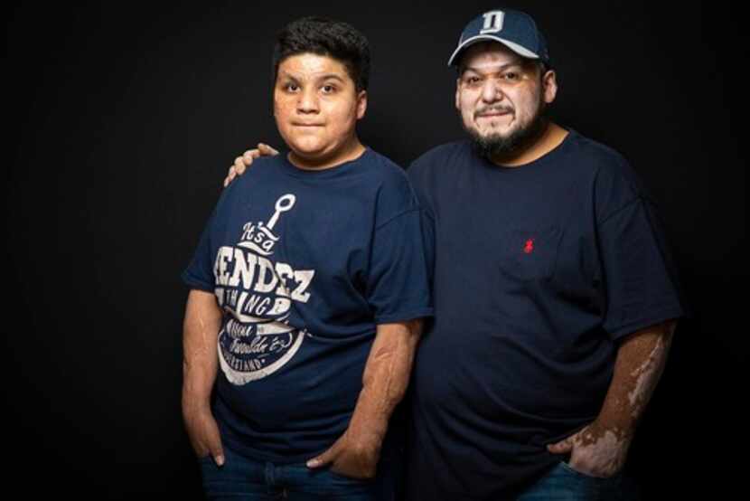 Domingo Méndez y su hijo Pablo, ahora de 12 años. Ambos sufrieron quemaduras y requirieron...