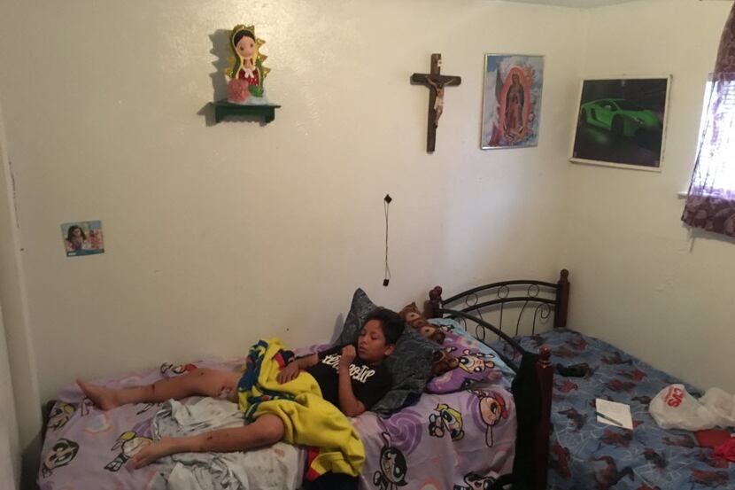 Jesus Galvan, 13, lay in his room in East Dallas on May 31, the day after he was attacked by...