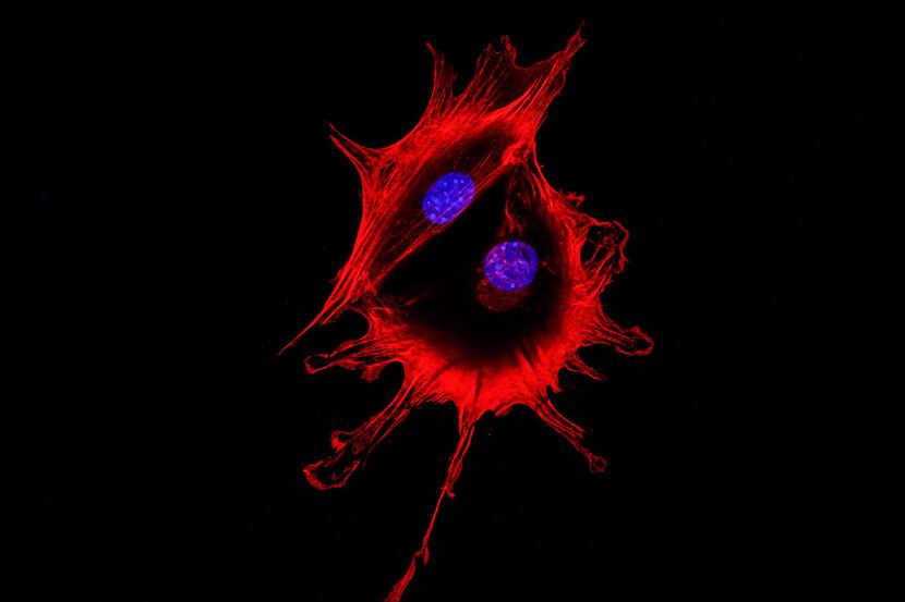 Microscopy imaging of two cancer cells.