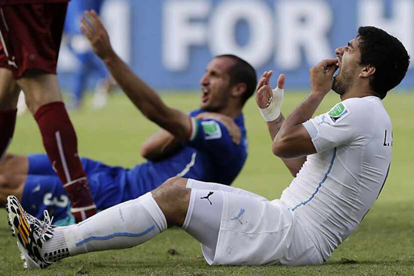 Uruguay's Luis Suarez holds his teeth after biting the shoulder of Italy's Giorgio Chiellini...