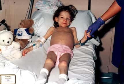 In a photo of Lauren taken at Children's Medical Center Dallas, she had the skeletal look of...