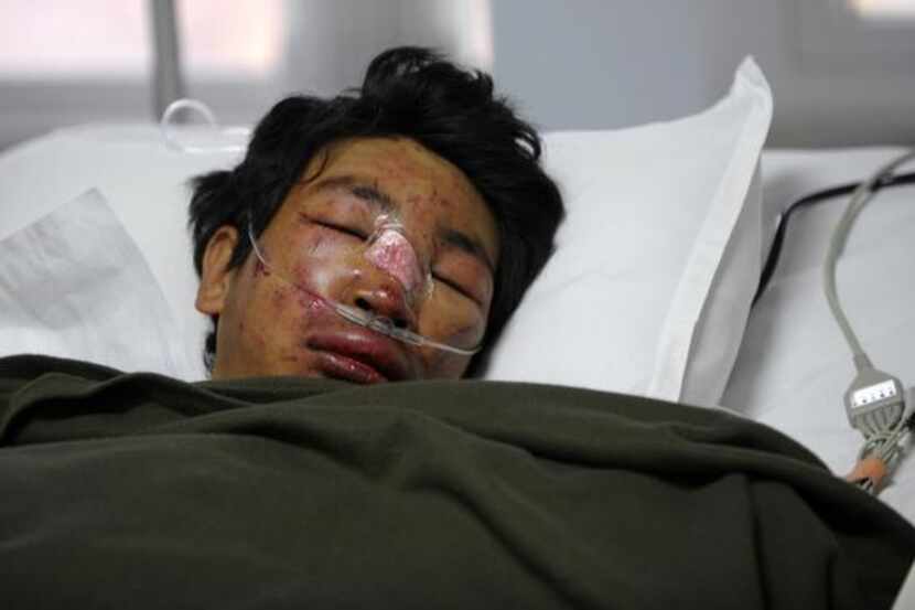 
Dawa Tashi Sherpa, a survivor of the avalanche on Mount Everest, was flown to a hospital in...