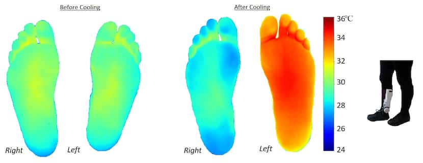 The temperature of patients' feet at rest (left) and the temperature of their feet after...