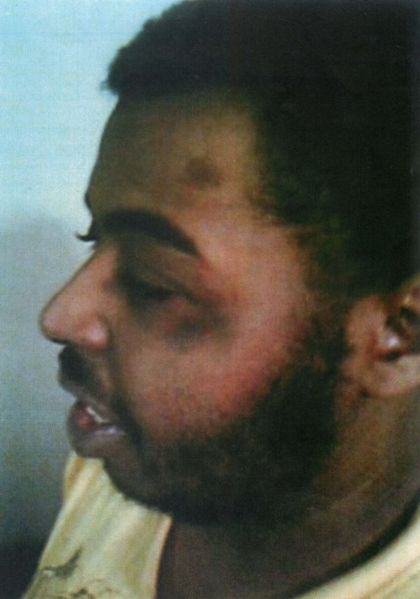 Relatives took cellphone pictures of Micah Hughey's facial bruises after he returned home....