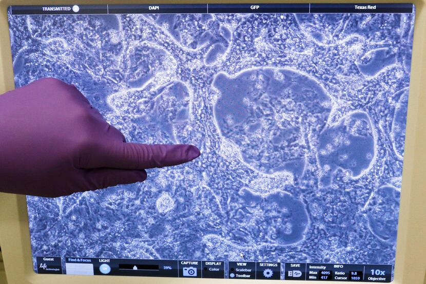 Eric Olson's lab assistant Leonela Amoasii points out heart cells on a computer screen in...