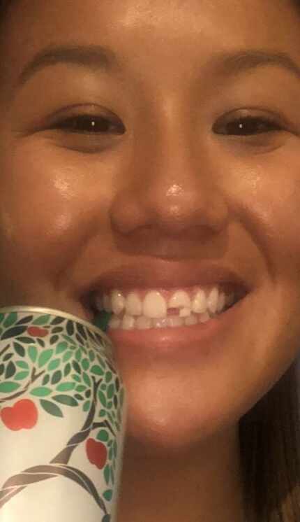 West Village resident Olivia Schmitt said she chipped her front tooth while riding a scooter...