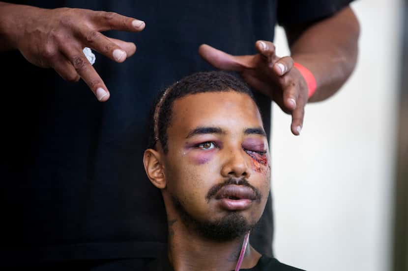 Andre Ray shows the injuries his son Brandon Saenz suffered when he was hit with less-lethal...