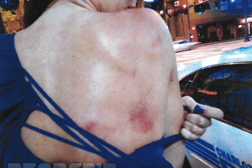 "Photo showing Holder's back bruises".  A police evidence photo obtained by Deadspin, taken...