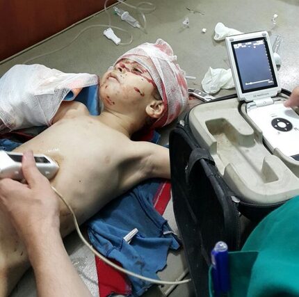 Ahmad Tadifi, 2, underwent surgery for injuries to his head, groin and right arm and leg...