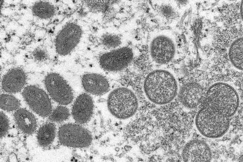El virus de la viruela del mono se transmite a través de secreciones, pero incluso puede...