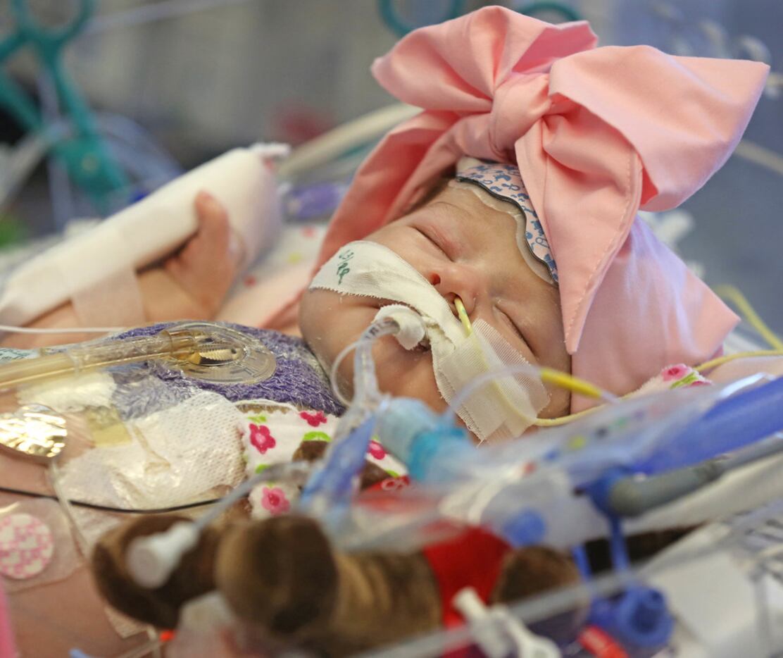 Olivia Rene Faith Solis remains in intensive care. Her parents say there's no way they can...
