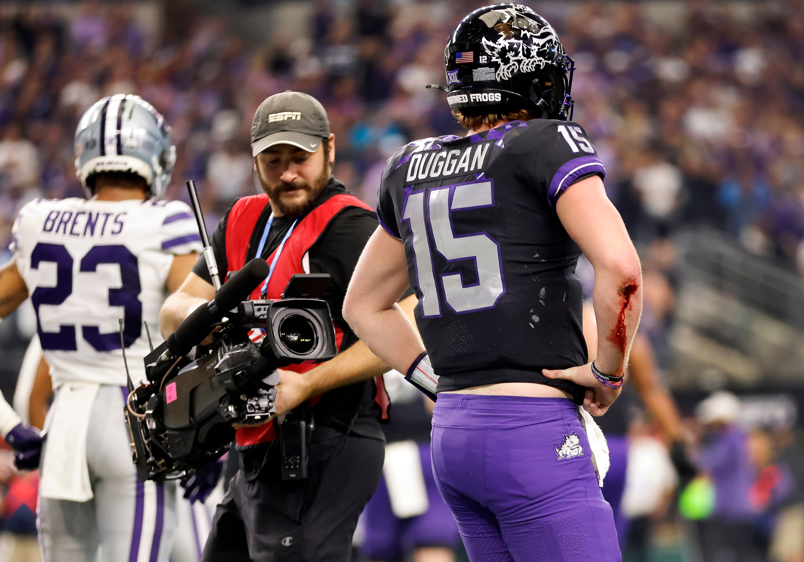 TCU Horned Frogs quarterback Max Duggan (15) was slow to get up partially due to his...