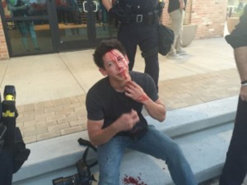  Photographer Danny Fulgencio, photographer for the Dallas Advocate, was struck in the face...