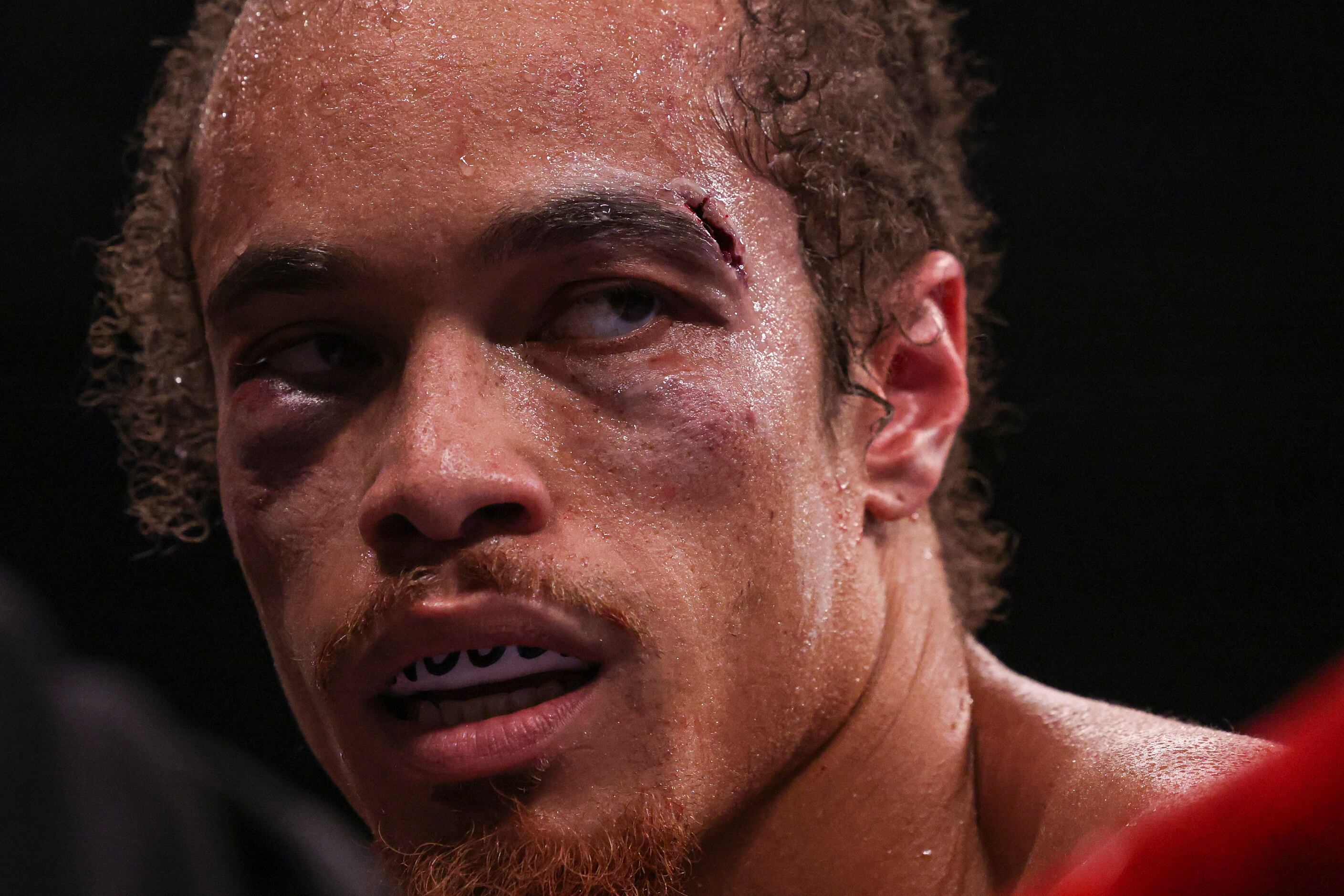 Blair Cobbs looks back towards the ring after getting blood wiped off his face during the...