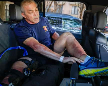 Dallas Fire-Rescue firefighter Ronald W. Hall shows burn scars while speaking with media...