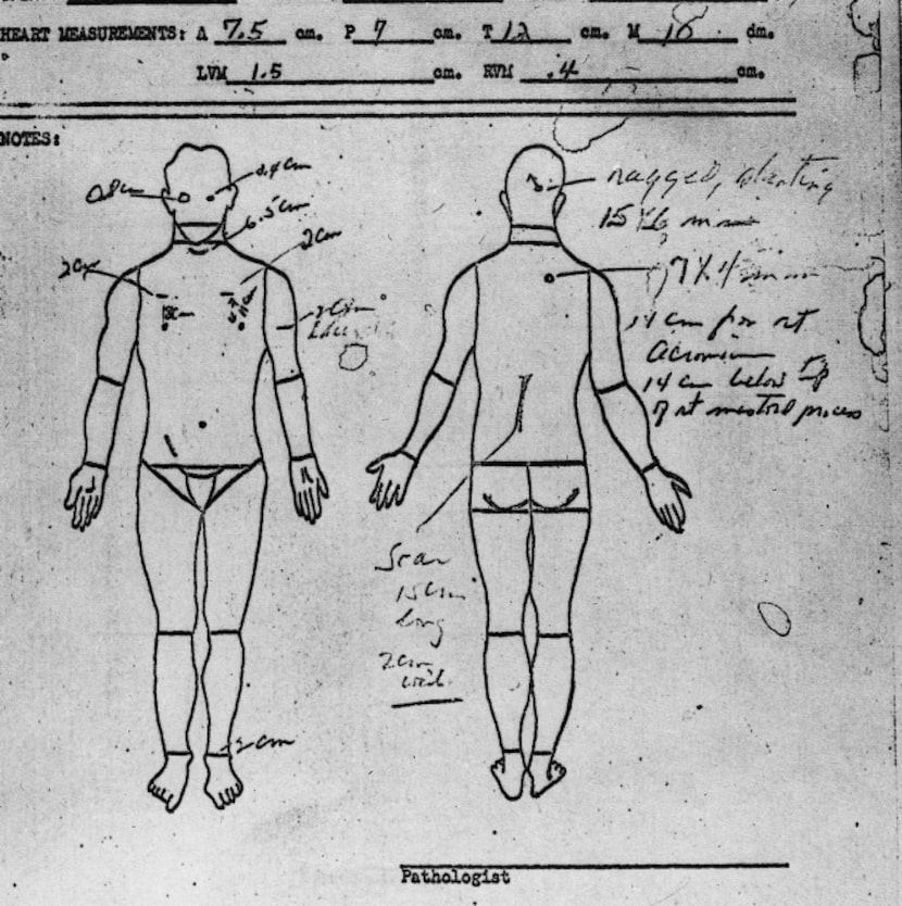 This autopsy sketch is part of the report of the President's Commission on the Assassination...