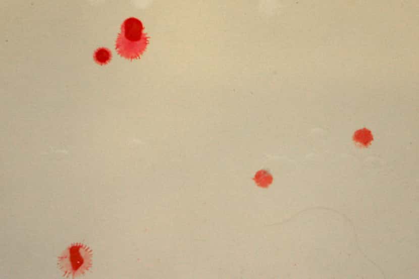 A lead testing kit showed spots where the toxic metal was present in the bathtub of the...