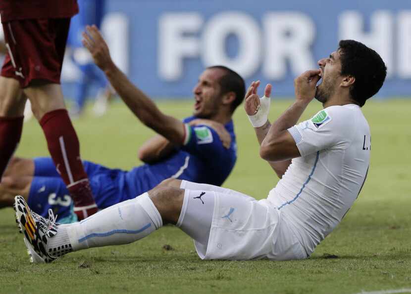 FILE - In this June 24, 2014, file photo, Uruguay's Luis Suarez holds his teeth after...