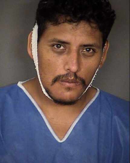 Armando Garcia-Ramires shot himself in the mouth shortly before his arrest. (Bexar County Jail)