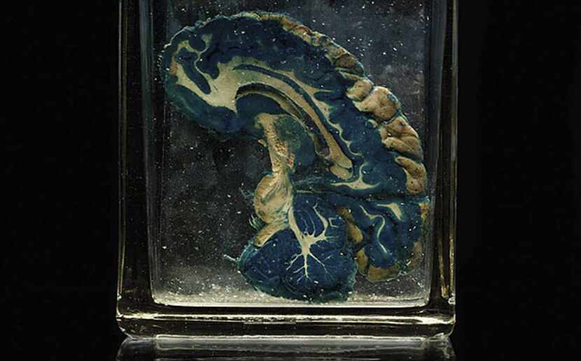This undated handout photo shows a dyed segment of a brain. About a hundred similar...