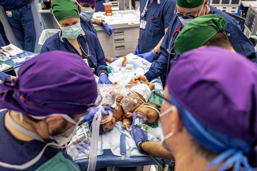 A team of medical professionals operate on conjoined twins JamieLynn and AmieLynn at Cook...