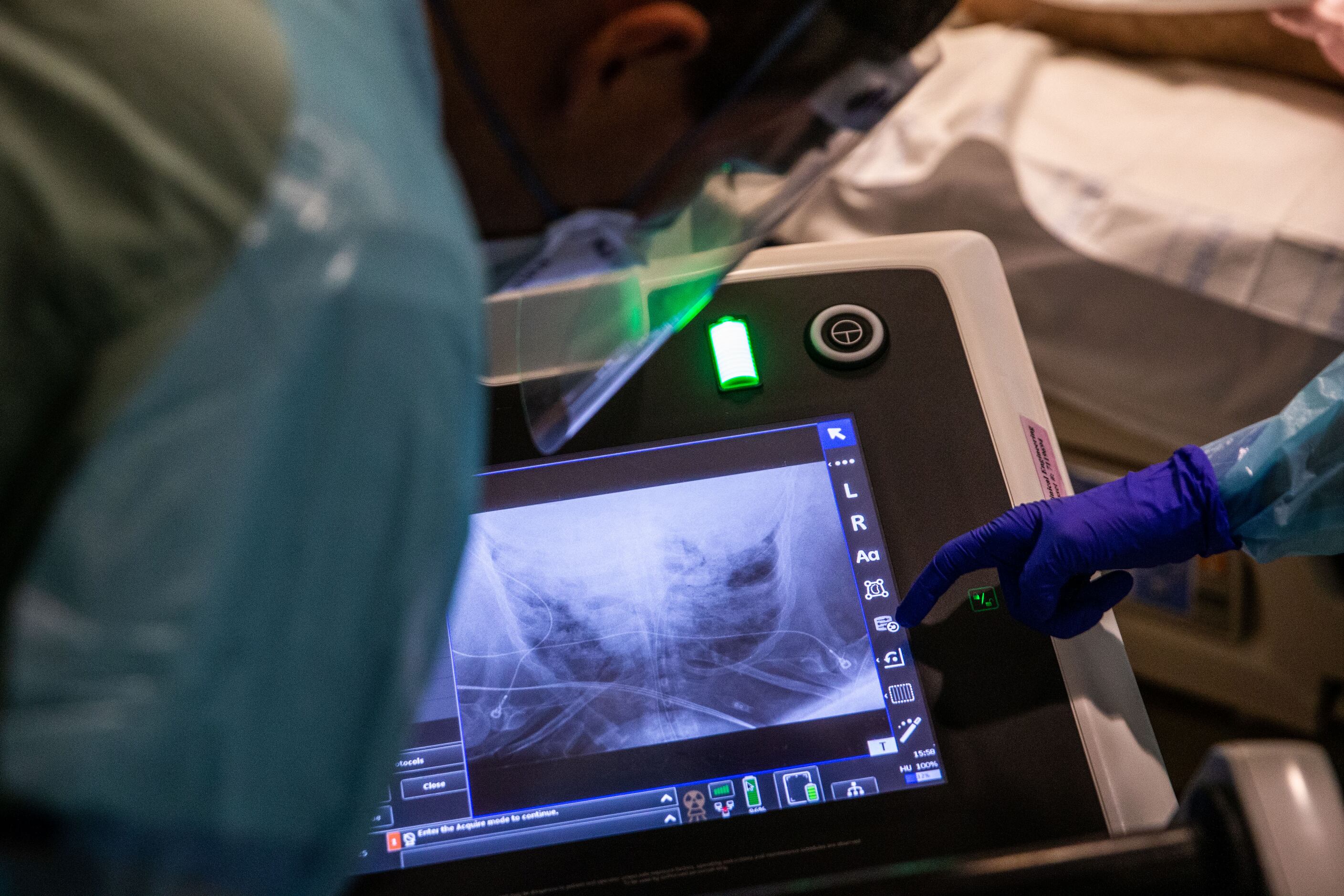 Parkland medical staff review an X-ray of a COVID-19 patient’s chest to make certain his...