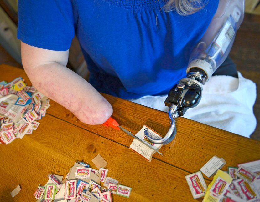 
Kuehn’s current prosthetic hands and feet are temporary as she adjusts to performing basic...