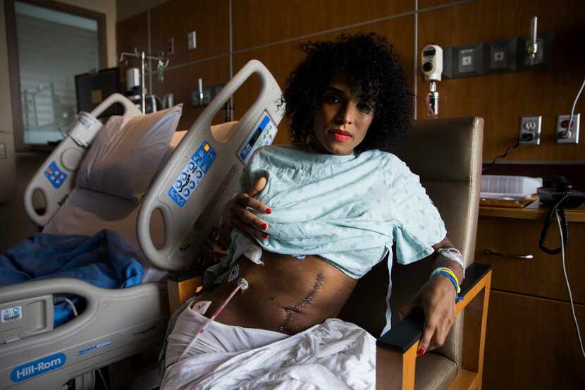 Daniela Calderon holds up her hospital gown to show scars on her abdomen from surgery in her...