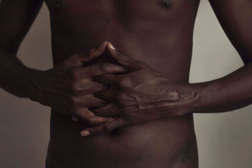 Abdoul, 32 year-old migrant from Maghama, Mauritania poses for a photograph showing surgery...