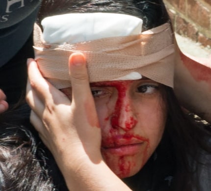 People receive first aid after a car plowed into a crowd of protesters in Charlottesville, Va.