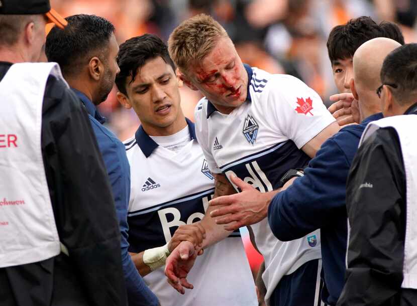 Blood runs down the face of Vancouver Whitecaps's Andy Rose as he is helped up by teammates...