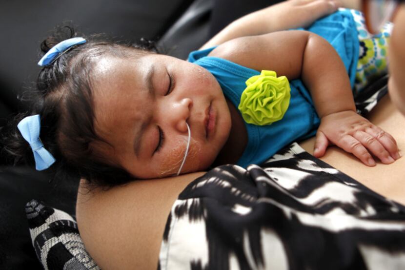 Jenny Torry holds her 5-month-old daughter, Milan. The little girl had a severe congenital...