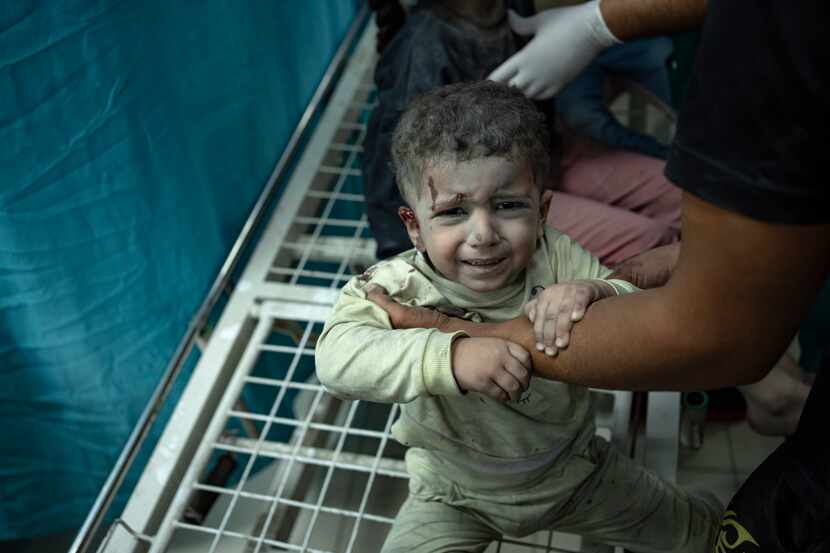 A Palestinian child wounded in Israeli bombardment of the Gaza Strip is brought to a...
