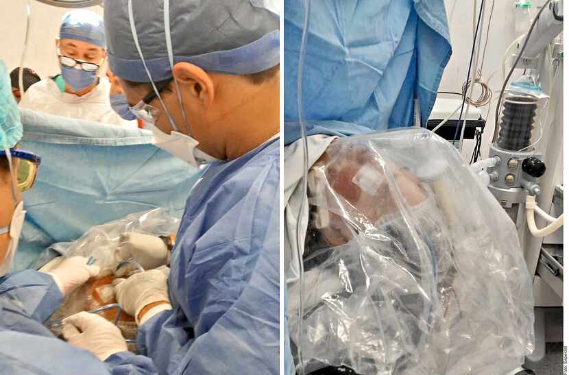 Ante falta de insumos, médicos del hospital Balbuena en México cubrieron con bolsa de...