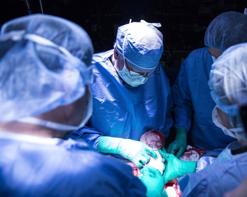 The team at Baylor, including (from left) doctors Paul B. Payne, Robert T. Gunby Jr.,...