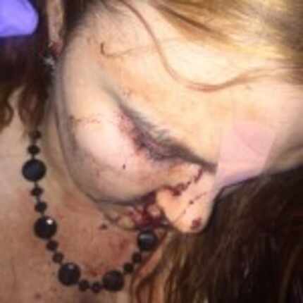  Sarah Hoff was beaten and carjacked in downtown Dallas. (Provided)